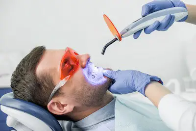 Profesional Teeth Whitening