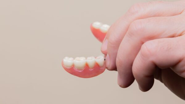 Dentures Vs Implants