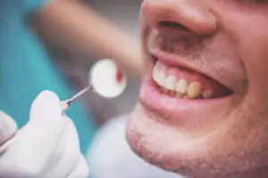 Professional teeth whitening dentist