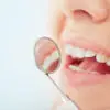 fluoride for teeth