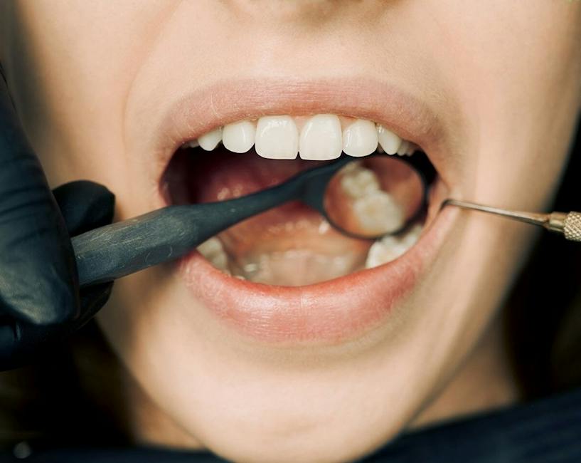 Understanding Tooth Loss